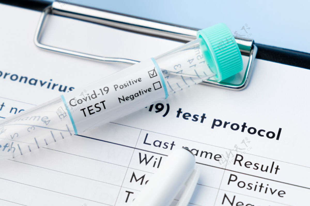 疾病特写阳性covid-19试管和医学测试方案医学诊断试管