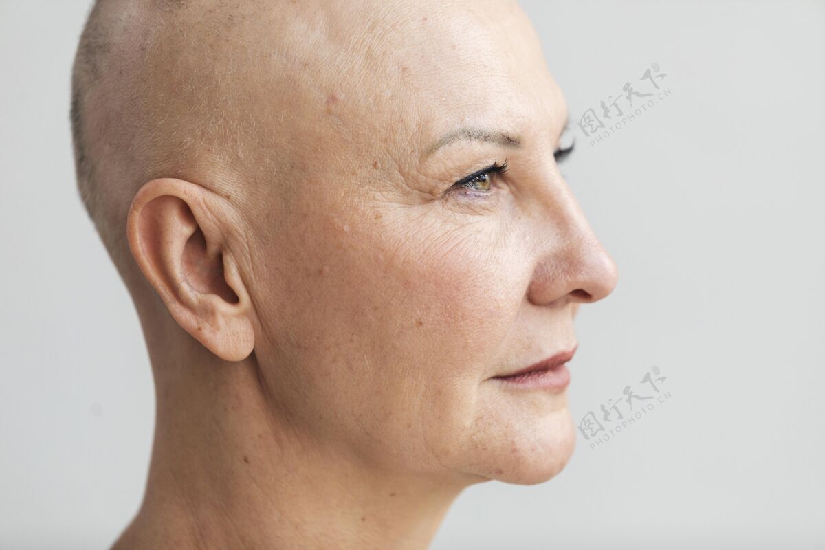 战斗皮肤癌妇女的画像意识希望健康